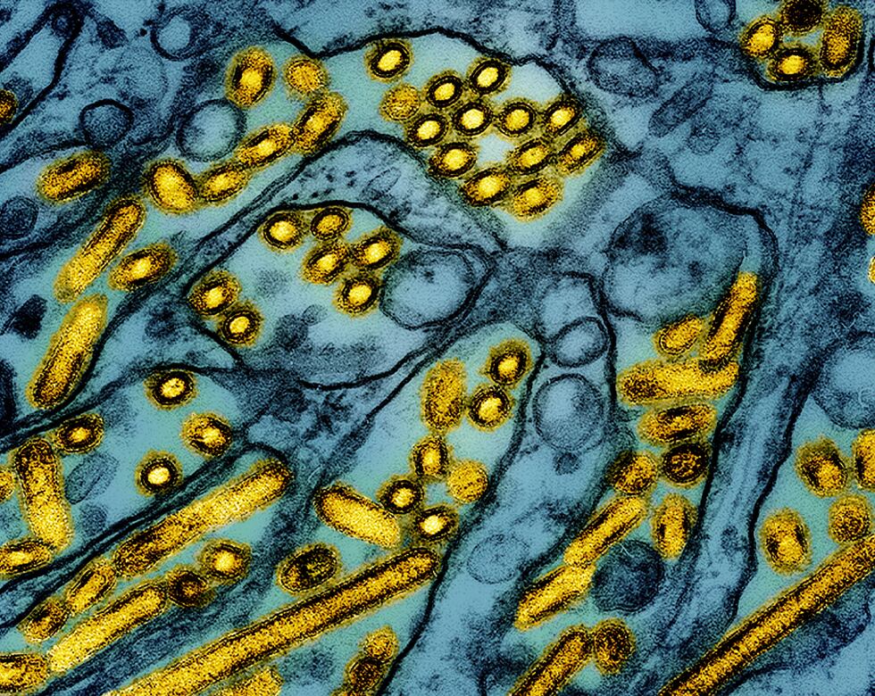 En esta imagen iluminada de un microscopio de electrones difundida por el Instituto Nacional...