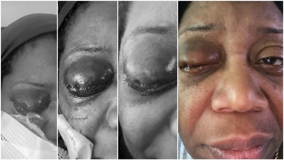 Candra Rogers' injury