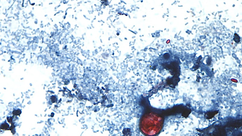 This undated photo taken through a microscope provided by the CDC shows Cyclospora...