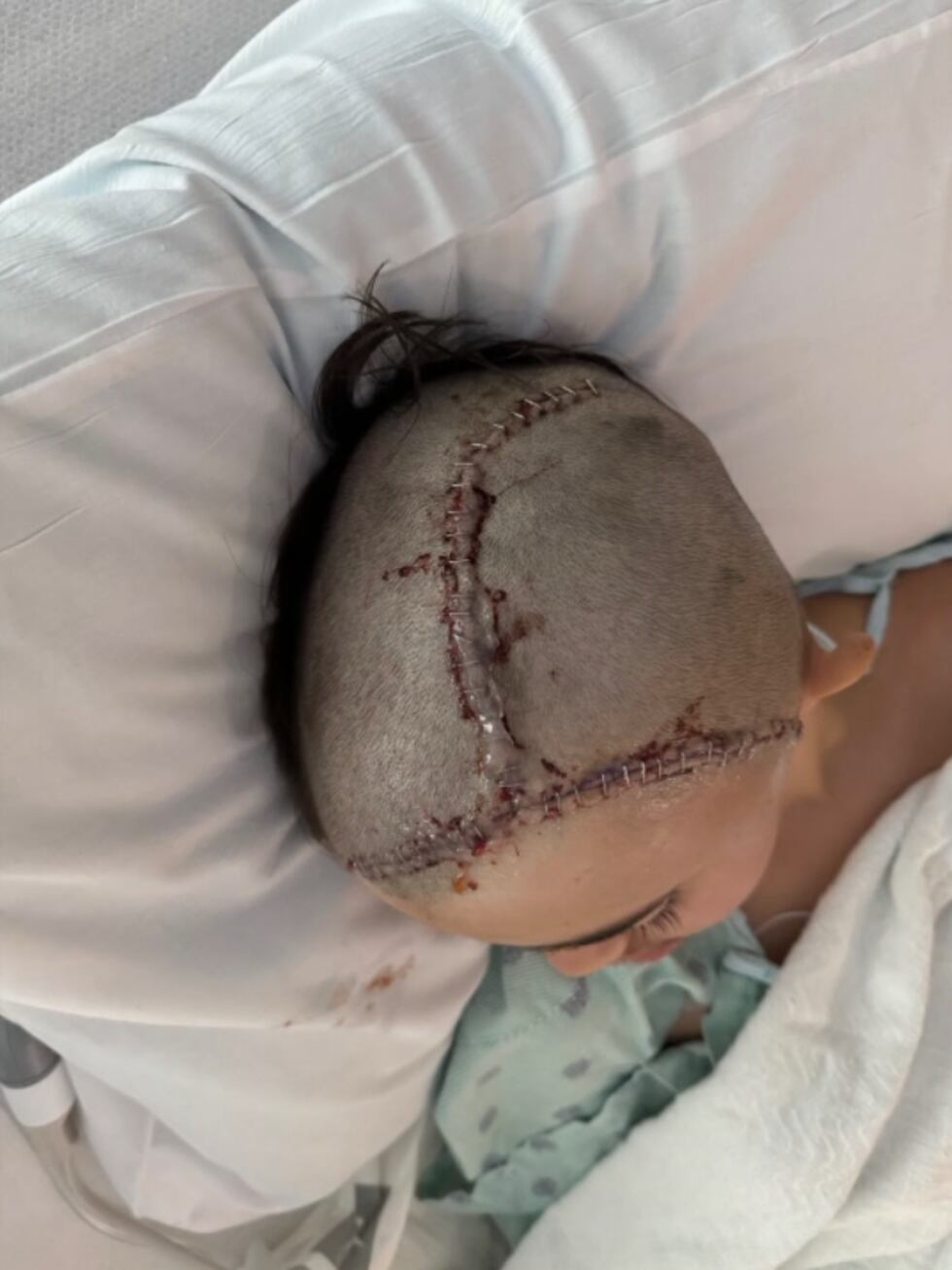 Padres de Kilgore ISD piden mayores medidas de seguridad después de que un incidente en la...