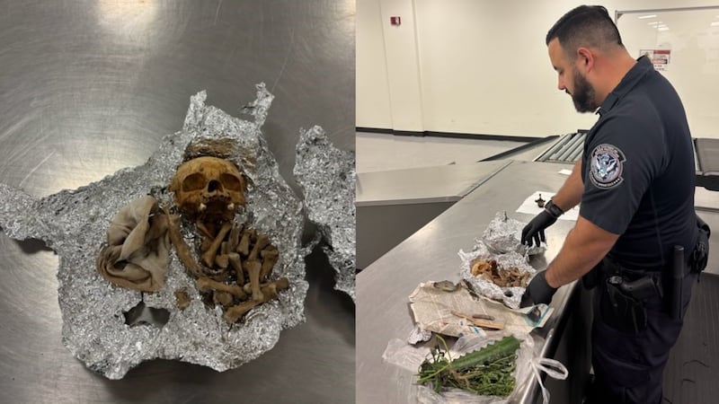 A traveler at an airport in Florida was accused of having what looked like human remains,...
